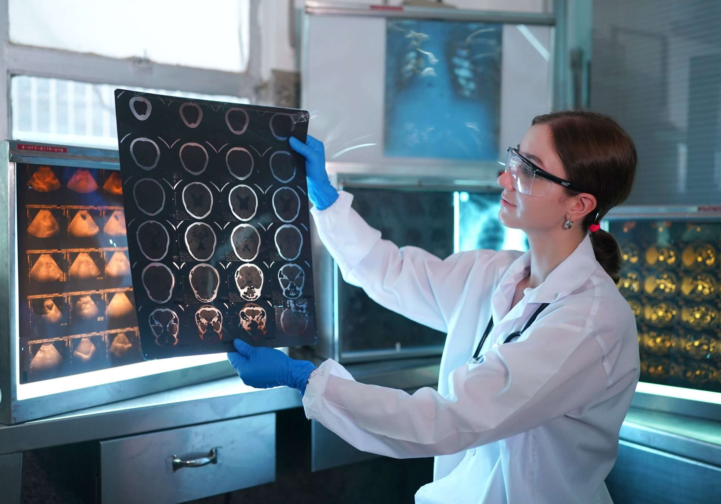Doctor looking at x-ray image. Female medical doctor looking at x-rays in a hospital. Healthcare surgery diagnosis concept